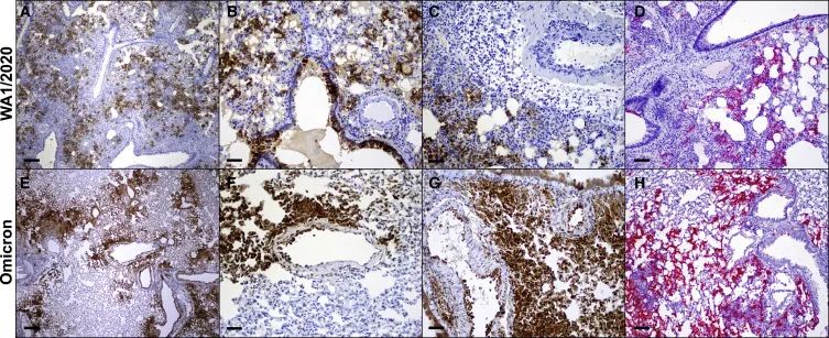 倉鼠試驗(yàn)：SARS-CoV-2 omicron變異體的致病性降低(圖5)